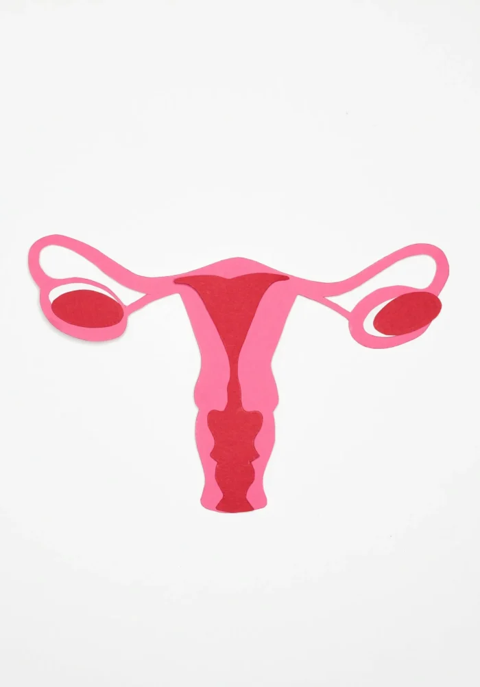 PCOS
